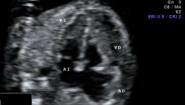 ¿Desde cuándo se puede evaluar la anatomía cardíaca fetal? 